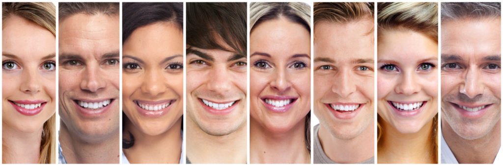 Airdrie Springs Dental can help with all of your questions about Veneers!