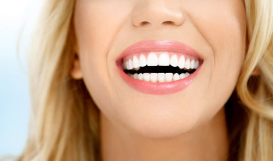 Teeth Whitening - Airdrie Springs Dental