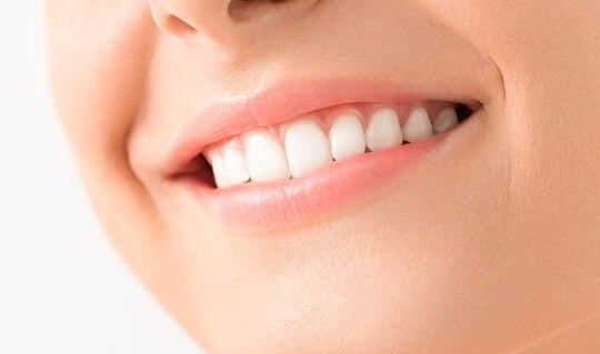 teeth whitening- Airdrie Springs Dental