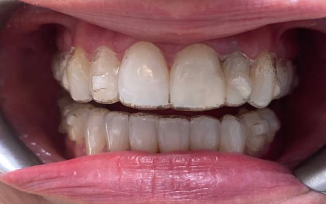 Before & After Case Study - Airdrie Springs Dental