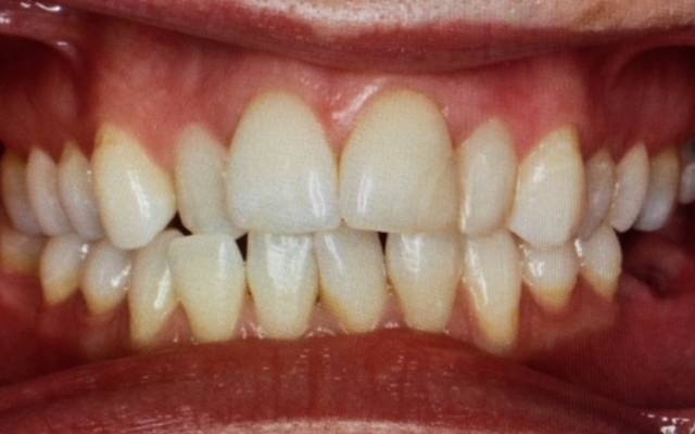 Before & After Case Study - Airdrie Springs Dental