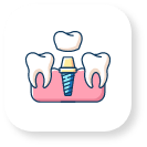 Cosmetic Dental Crowns