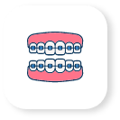 Cosmetic Orthodontic Treatment