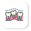 Cosmetic Teeth Shaping