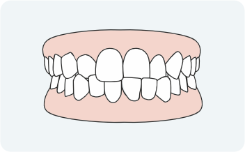 Misaligned or asymmetrical teeth