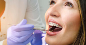 Orthodontic Airdrie- Airdrie springs dental
