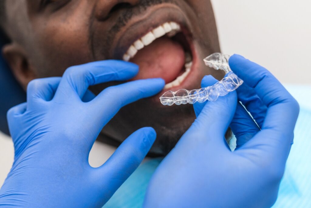 Invisalign-in-Airdrie