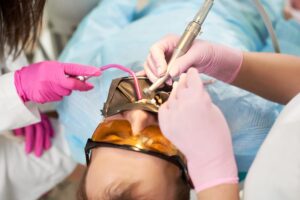 Root Canal Treatment in Airdrie