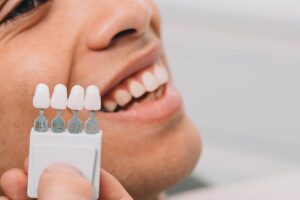 Veneers in Airdrie